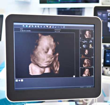 Servicios Radiológicos en Guanajuato