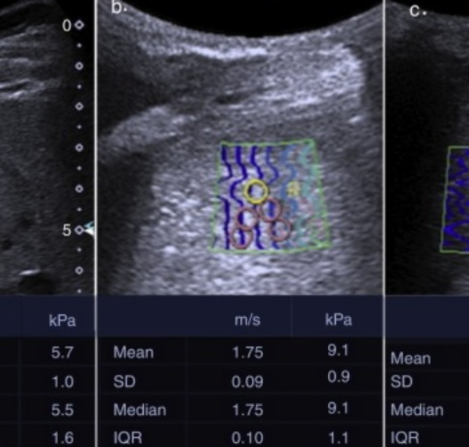 Servicios Radiológicos en Guanajuato